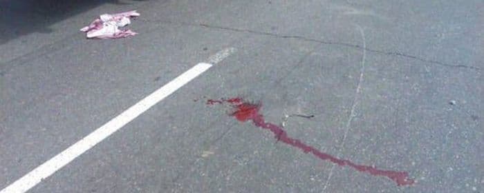  В Яранске легковушка насмерть сбила женщину