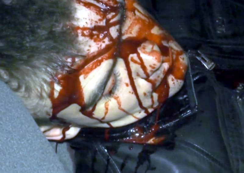 Тройное ДТП на Комсомольской: водителя остановило дерево