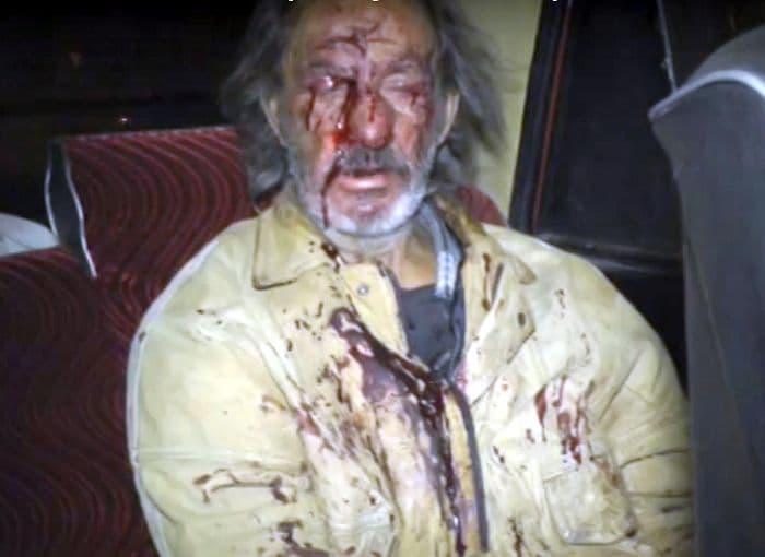 Погоня в Кирове закончилась кровью: пьяному водителю грозит арест