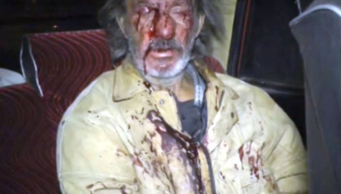 Погоня в Кирове закончилась кровью: пьяному водителю грозит арест