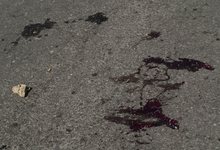 На переходе у «Глобуса» в Слободском сбили женщину